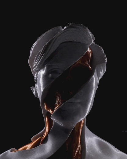 Whirls Anatomy